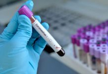 Міська лікарня №7 забезпечена експрес-тестами