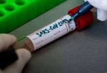 Ще один випадок коронавірусної інфекції у Кам’янському