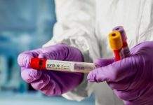 Дніпропетровщина готова до чергового послаблення карантину