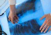 Не COVID-19 единым: Ляшко напомнил об угрозе туберкулёза