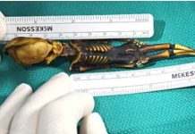 «Инопланетянин» из Атакамы оказался недоношенной девочкой