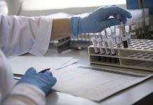 Серія випадків: в Індії ті, хто видужали від коронавірусу, інфікувалися рідкісним “чорним грибком”