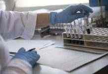 Чи варто робити тест на антитіла після COVID-вакцинації або одужання: відповідь МОЗ