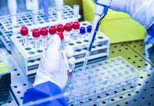 У Великобританії почалися випробування нової вакцини проти Еболи