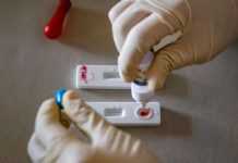 У Британії назвали ще один симптом зараження штамом “Омікрон”