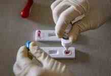 Вчені назвали ще один симптом зараження штамом “Омікрон”