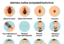 Мешканців Кам’янського попереджають про хворобу Лайма