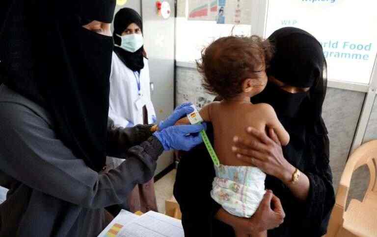 ООН попереджає про “катастрофічне” недоїдання дітей війни Росії проти України