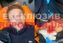 На Набережній Перемоги у Дніпрі підрізали переселенця: подробиці