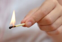 Грався з сірниками та бензином: до дніпровської лікарні госпіталізували хлопчика з опіками обличчя