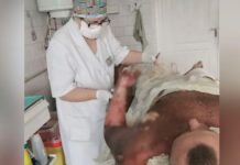 У Дніпрі врятували бійця з опіком 90% поверхні тіла: деталі