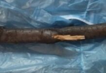 Побив палицею та забрав сумку: у Кам’янському затримали 34-річного нападника