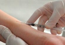 Що буде, якщо намочив Манту і чому цього не варто допускати