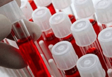 Група крові та хвороби: які ризики існують для носіїв кожної групи