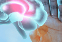 Можуть стати причиною інсульту: лікарі рекомендують обмежити вживання цих продуктів