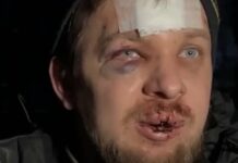 Операція «Барабаш»: хто і з якою метою пустив кров активісту в Кам’янському?