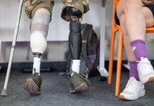 Протезування для військових та цивільних: які документи потрібні