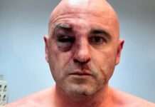 Лідера опозиційної партії Грузії жорстоко побили – у нього вибитий зуб, є переломи кісток обличчя