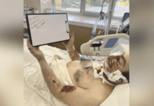 Ампутація обличчя: у Дніпрі рятують важкопораненого бійця