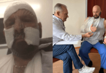 Уламок потрапив в око: лікарі Дніпра врятували Захисника з Тернопільської області