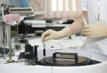 Сезон холери розпочався: що це за хвороба та як її уникнути