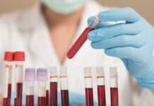 Окупанти змушують бюджетників здавати кров для поранених солдатів, – ЦНС