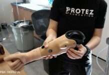 У Кабміні нагадали українцям, як безкоштовно отримати протез