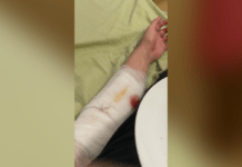 «Готовий на все, тільки б не захищати рідну країну»: в Закарпатському ТЦК чоловік намагався покінчити з життям