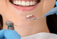 Як безпечно відбілити зуби: стоматолог назвав ТОП-3 ефективні способи