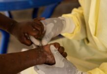 У Швеції заявили про перший випадок нового штаму мавпячої віспи за межами Африки