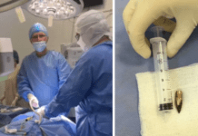 Справжнє диво: у Дніпрі лікарі дістали смертоносну кулю з важкопораненого захисника