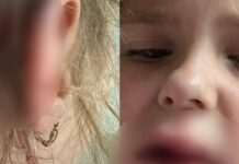 У Кам’янському хлопець на електросамокаті збив 6-річну дівчинку: дитину прооперували