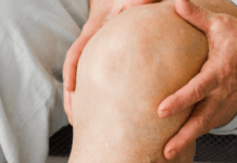 Як розпізнати біль у суглобах і чому він виникає: пояснення лікаря