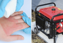 Необережне поводження з генератором: у Кривому Розі 8-річну дівчинку вдарило струмом