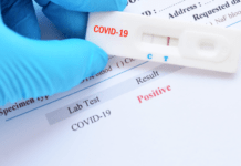 На Дніпропетровщині п’ятеро людей померли від COVID-19