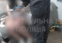 Патрульні Запоріжжя допомогли жінці зі скривавленою рукою