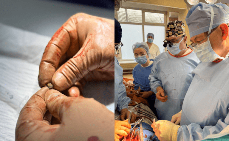 Серце довелося повністю зупинити: у Дніпрі провели унікальну операцію важкопораненому військовому