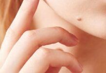 Що розповідають родимки: психологічний і символічний аналіз жіночої індивідуальності