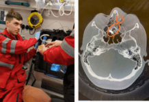 У Камʼянському районі жінка випадково вистрілила собі в голову: подробиці