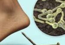 На Дніпропетровщині від правця помер 14-річний хлопець