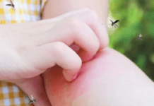 Мошки у квартирі: як прогнати небажаних гостей простим народним способом