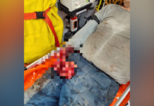 У Дніпрі чоловік втратив руку на виробництві