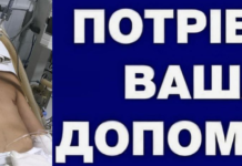 У Кам’янському 14-річний підліток постраждав у страшній ДТП: рідні просять про допомогу