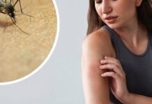 Укус комахи: три найважливіші поради, щоб уникнути важких наслідків
