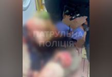 У Запоріжжі патрульні надали допомогу чоловікові після вибуху гранати