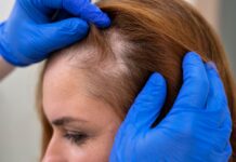 Ця популярна зачіска може спричинити облисіння