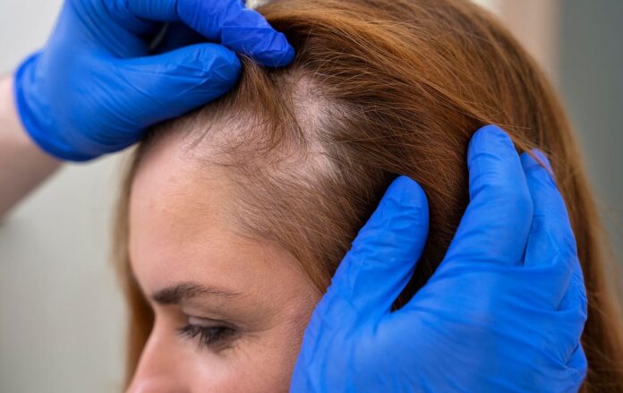 _dermotolog_woman_getting_a_hair_loss_treatment_at_a_clinic_095cdb62d6830879ba9aadca71bd47a2_1300x820