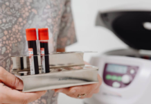 В одній із гімназій Дніпра зафіксовано спалах кору: епідемічна ситуація в області