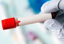 Пільги для донорів скоротили: що саме скасували і чому