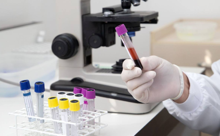 Помер 69-річний чоловік: у Дніпрі зафіксували смерть від грипу А